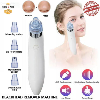 Derma Suction Blackheads Remover Device